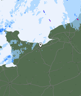 Radar