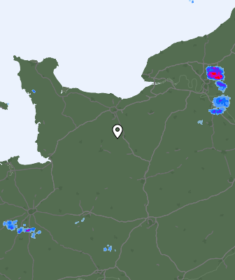 Radar