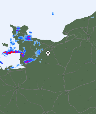 Radar