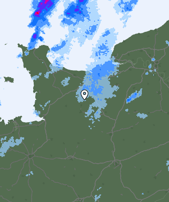 Radar