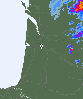 Radar