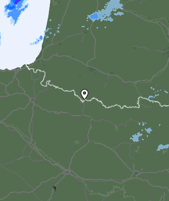 Radar