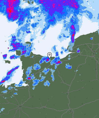 Radar