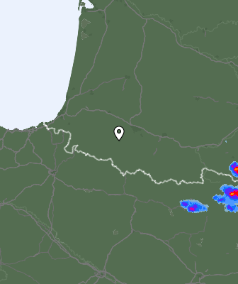 Radar