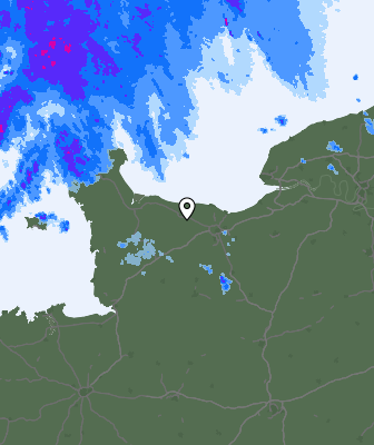 Radar