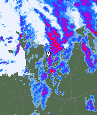 Radar