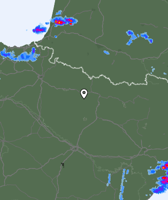 Radar