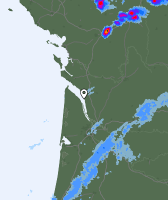 Radar