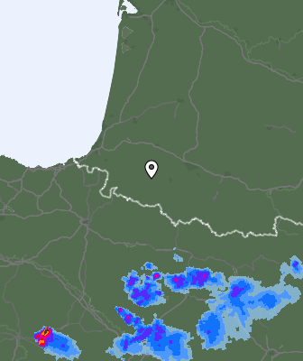 Radar