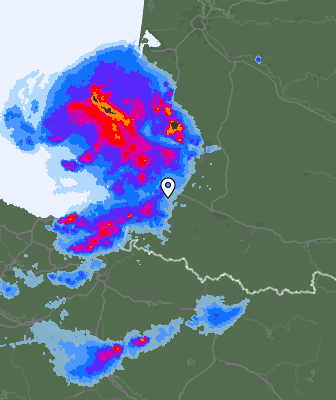 Radar