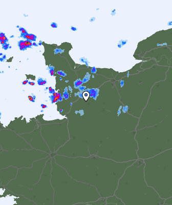Radar