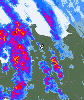 Radar