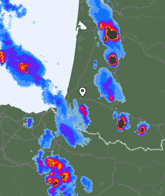 Radar