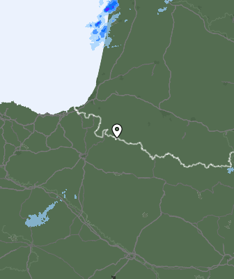 Radar