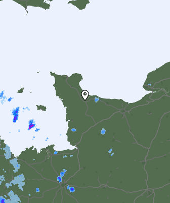 Radar