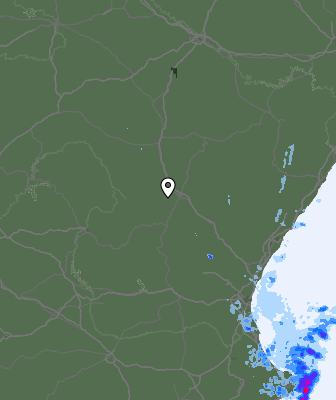 Radar