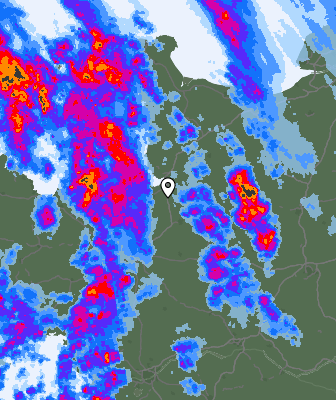 Radar