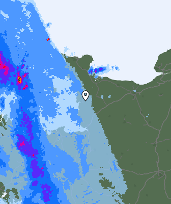 Radar