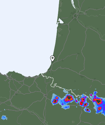 Radar