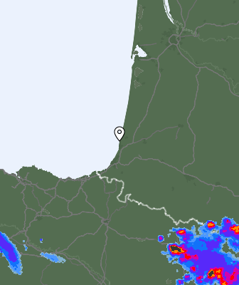 Radar