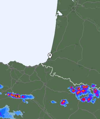 Radar