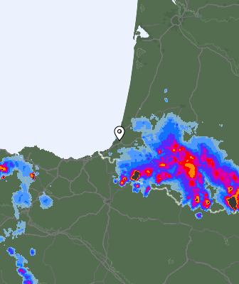 Radar