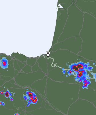 Radar
