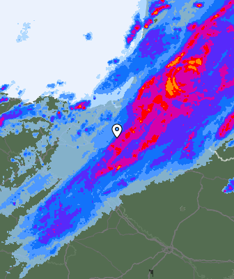 Radar
