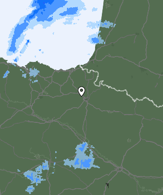Radar