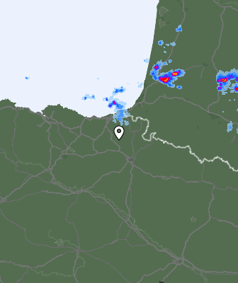 Radar