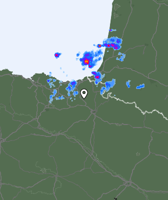 Radar