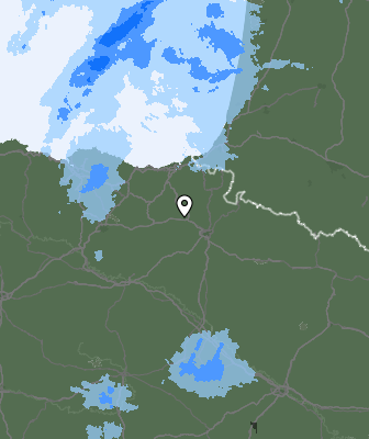 Radar