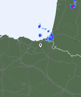 Radar