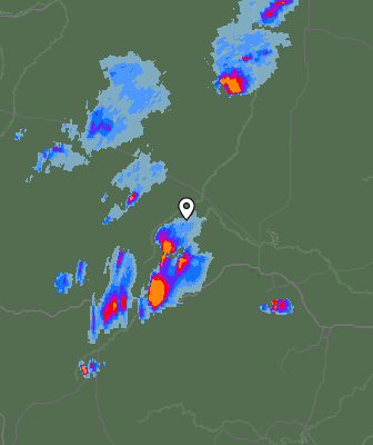 Radar