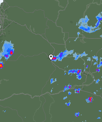 Radar
