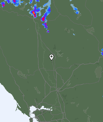 Radar