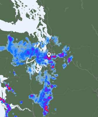 Radar