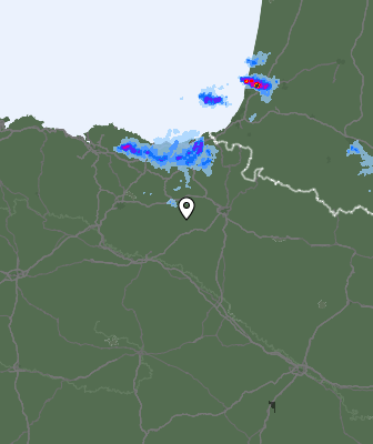 Radar
