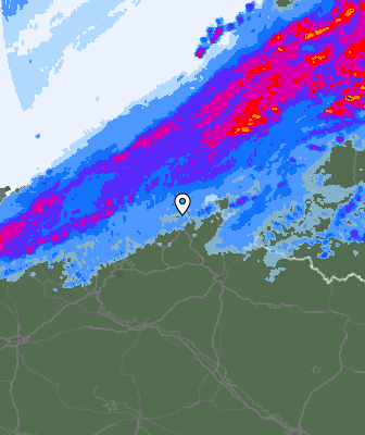 Radar