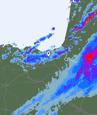Radar