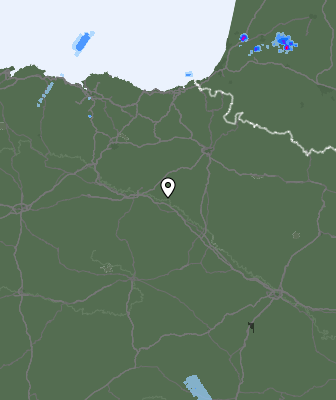 Radar