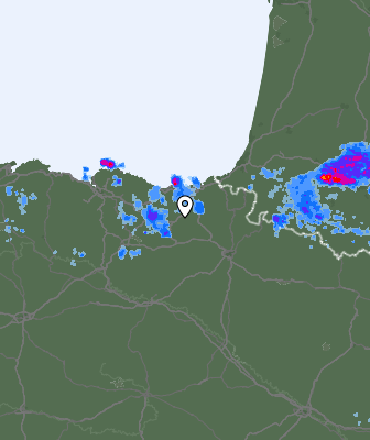Radar