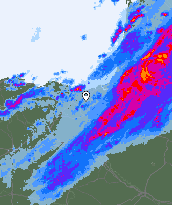 Radar