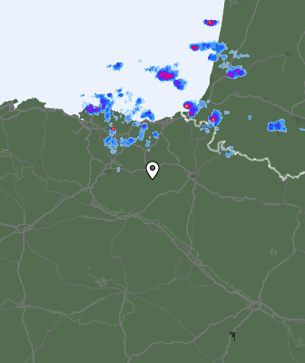 Radar