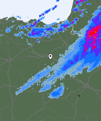 Radar