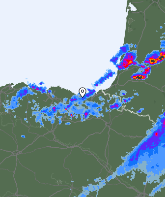 Radar