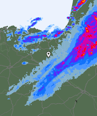 Radar