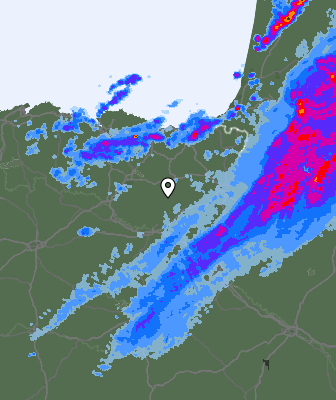 Radar