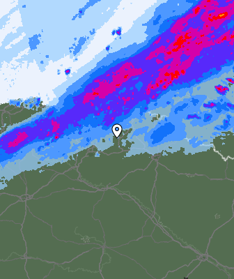 Radar