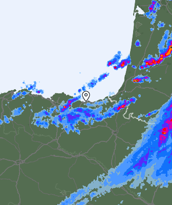 Radar